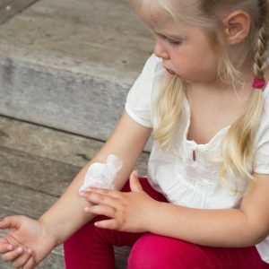 home remedies for kids eczema