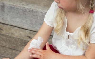 Eczema Home Remedies for Kids