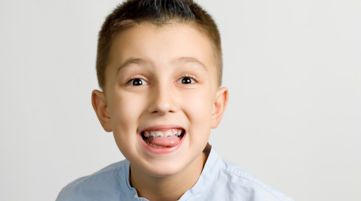 signs your child may need braces