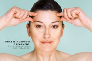 What Is Morpheus Treatment?