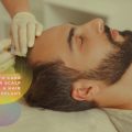 How to Care for Your Scalp After a Hair Transplant