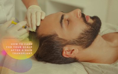 After Hair Transplant Care – Treating Scalp Effectively
