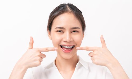 the role of braces to oral health