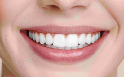 7 Cosmetic Dental Treatments For Smile Enhancement